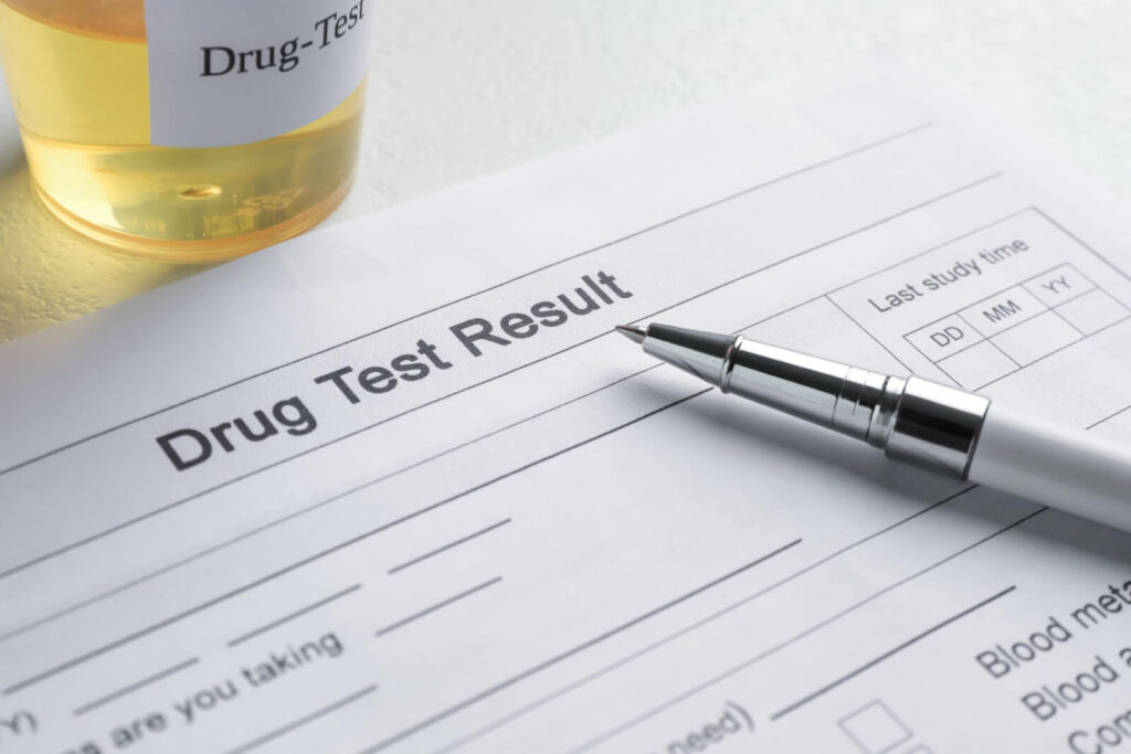 OVI urine test